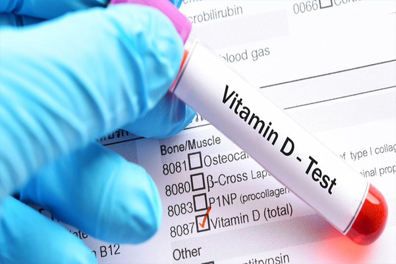 vitamin-D-test